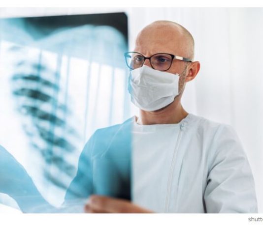 Un petit examen, une longue vie : le nouveau programme israélien de dépistage précoce du cancer du poumon entre en vigueur