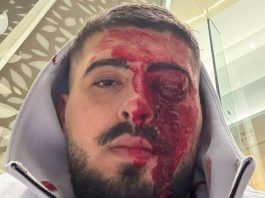 L’israélien violemment agressé à Chypre après avoir parlé hébreu a perdu la vue