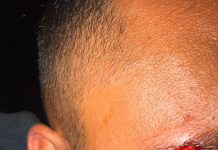 🔴« Vous êtes Israéliens ? » : Des agresseurs français attaquent des Israéliens à Koh Samui