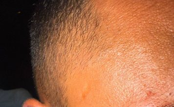 🔴« Vous êtes Israéliens ? » : Des agresseurs français attaquent des Israéliens à Koh Samui