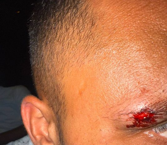 🔴« Vous êtes Israéliens ? » : Des agresseurs français attaquent des Israéliens à Koh Samui