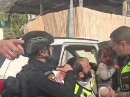 🔴 Impact direct à Beit Shemesh (videos) : deux blessés dans un état critique, deux graves et 14 blesses moyens