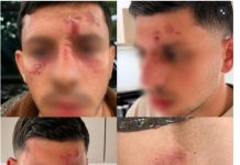 Shalom Beniakar attaqué à Londres : « Ils m’ont demandé si j’étais juif. Ils m’ont frappé et ont tenté de me déshabiller »