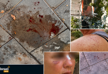 Agression Ă Ashdod : Il photographiait les filles de la famille près de la piscine, puis a agressĂ© ceux qui sont venus lui demander d’arrĂŞter
