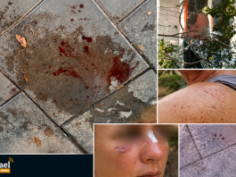 Agression à Ashdod : Il photographiait les filles de la famille près de la piscine, puis a agressé ceux qui sont venus lui demander d’arrêter