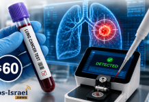 Un test sanguin israélien à 60 dollars détecte le cancer du poumon avec plus de 90 % de précision, sans séquençage de l’ADN
