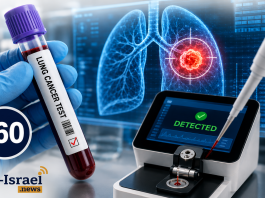 Un test sanguin israélien à 60 dollars détecte le cancer du poumon avec plus de 90 % de précision, sans séquençage de l’ADN